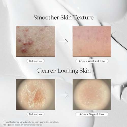 VT Cosmetics: Reedle Shot 300 | Intensive Micro-Needling | Skin Renewal | Anti-Aging | Deep Penetration | 30ml
