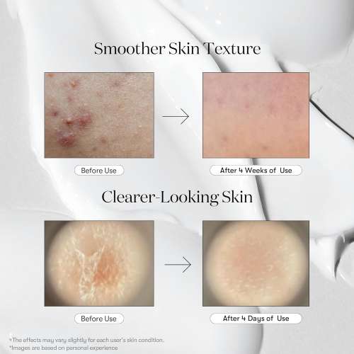 VT Cosmetics: Reedle shot 100 (30ml)