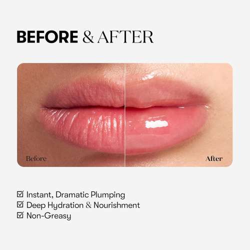 VT Cosmetics: Reedle Shot Lip Plumper Expert | Lip Volumizing | Intensive Micro-Needling | Plump Lips | Advanced Formula | 0.15oz