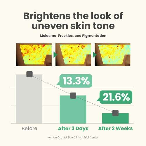 AXIS-Y: Dark Spot Correcting Glow Serum-50ml