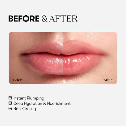 VT Cosmetics: Reedle Shot Lip Plumper Beginner | Lip Volumizing | Micro-Needling | Plump Lips | Starter Formula | 0.15oz