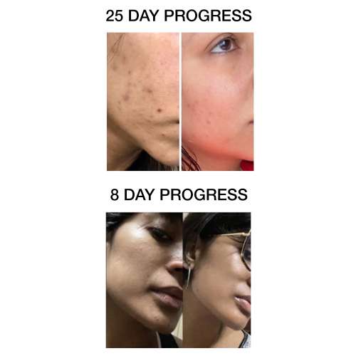 SKOG: Clarifying And Brightening Serum - 30ml