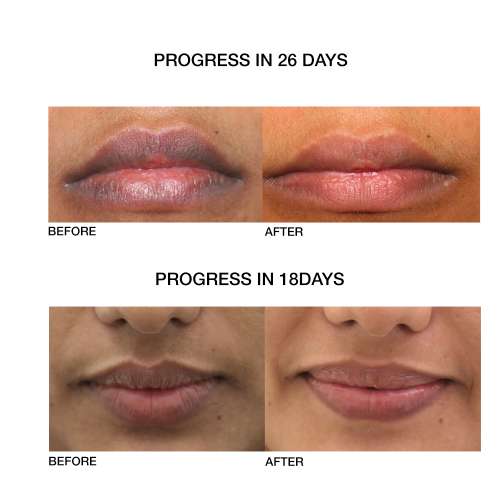 SKOG: Lip Repair Oil - 10ml