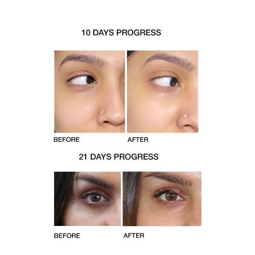 SKOG: Under Eye Repair Oil - 10ml