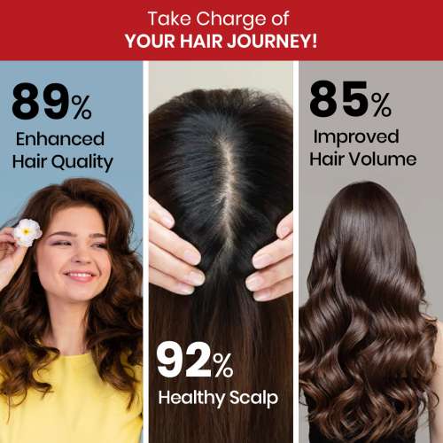 Vlado's Himalayan Organics: Plant Based DHT Blocker | Nettle Extract | 60 Veg Capsules