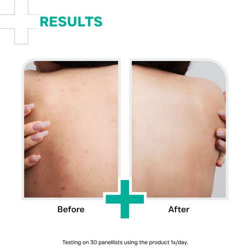 Dermatouch: DERMATOUCH AHA 10% BHA 1% Body Lotion for Men & Women - Body lotion for dry skin  De-tans, Moisturizing & Bumpy Skin / Suitable for All Skin Types 200ml