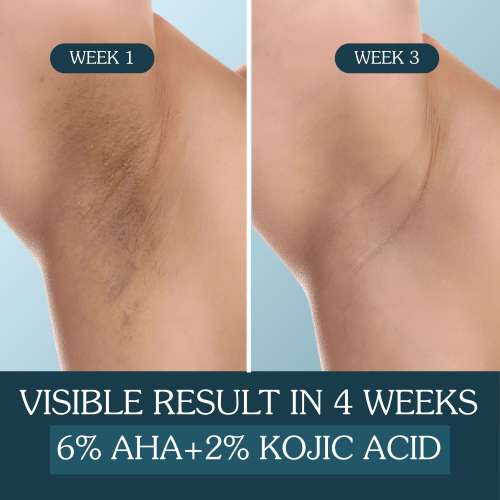 Bake Cosmetics: 6% AHA Underarm Brightening Roll On Serum with 2% Kojic Acid and 3% Niacinamide for Dark Underarms, Pigmentation & Odour Control - 50ml