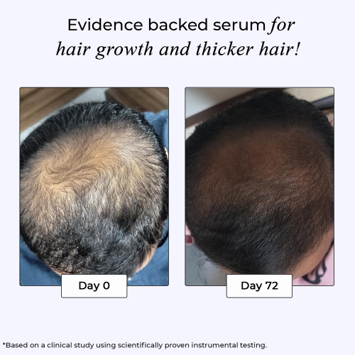 DR. SU: Dr. Su Revive Advanced Hair Growth Serum   50ml