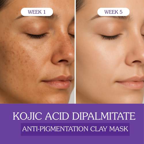 Bake Cosmetics: Bake 2% Kojic Acid Di palmitate Anti-Pigmentation Clay Mask for Dark Spots, Tan & Uneven Skin Tone  100gm