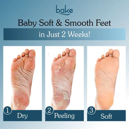 Bake Cosmetics: BAKE AHA + BHA Peeling & Exfoliating Foot Mask for Baby Soft Feet, Reduces Dry Skin & Calluses, Hydrates Skin - 1 Pair