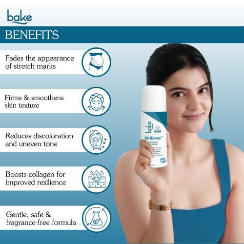 Bake Cosmetics: StriErase Stretch Marks Removal Roll On Serum with 0.5% Encapsulated Bakuchiol and 2% Centella Asiatica for Pregnancy Stretch Marks, Scars, Skin Firming & Smoothening  50ml