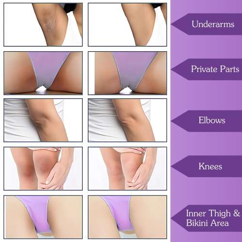 Bake Cosmetics: BAKE IntiErase Intimate Brightening Roll-On Serum with 5% Azelaic Acid & 5% Niacinamide Reduces Pigmentation, Lightens Dark Spots for Dark Underarms, Inner Thighs, Bikini Area  50ml