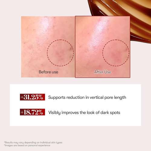 VT Cosmetics: Red Booster Reedle Shot 100 | Energy Boosting | Micro-Needling | Glow Boost | Skin Renewal | 50ml