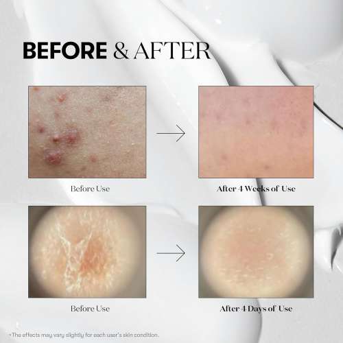 VT Cosmetics: Reedle Shot 100 300 700  (10ml*3Ea) Trial Kit