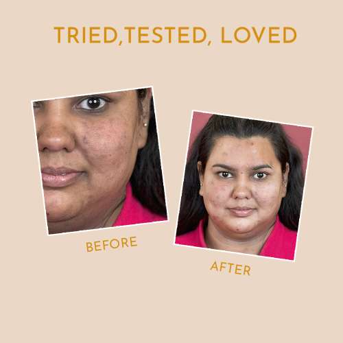 Himaira: Vitamin C Face Wash - 100ml