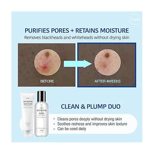 Jumiso: Pore Purifying Salicylic Acid Foaming Cleanser, 120gm