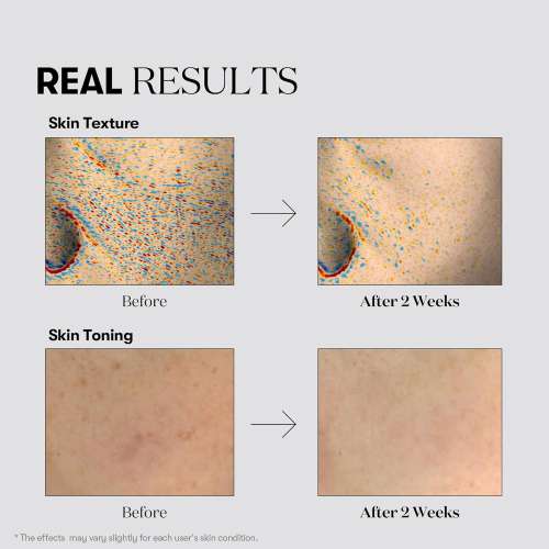 VT Cosmetics: TX-Toning Daily Mask  30Ea