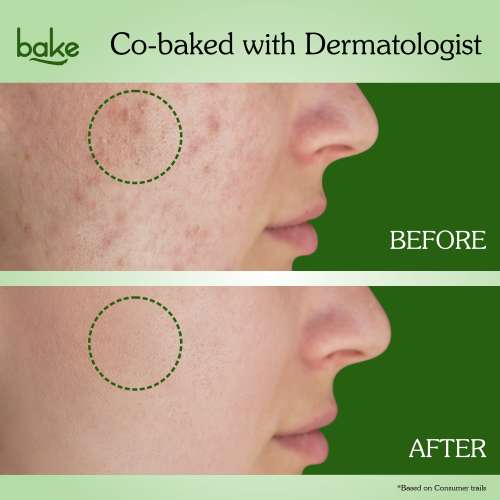 Bake Cosmetics: Bake 3% Niacinamide + 2% Salicylic Acid Face Wash For Acne & Acne Marks