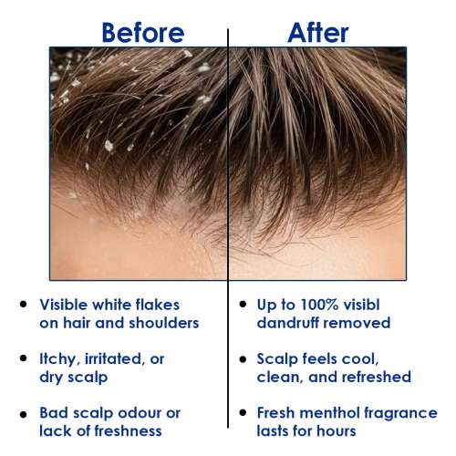 Mancode: Zinc + Menthol Anti-Dandruff Shampoo for Men and Women, 400ml | Cooling & Refreshing Formula with Zinc Pyrithione to Control Dandruff, Itchy Scalp & Excess Oil | Deep Cleansing Hair Shampoo for Strong, Flake-Free Hair