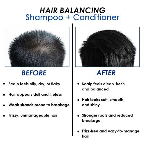 : 10% Niacinamide Hair Balancing Shampoo + Conditioner 400ml for Men and Women| Dual Action Formula for Oil Control, Strength & Shine | 400ml | For Men & Women | Reduces Hair Fall & Dandruff