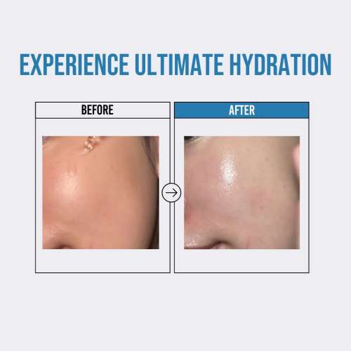 Jumiso: Waterfull Hyaluronic Acid Serum, 50ml