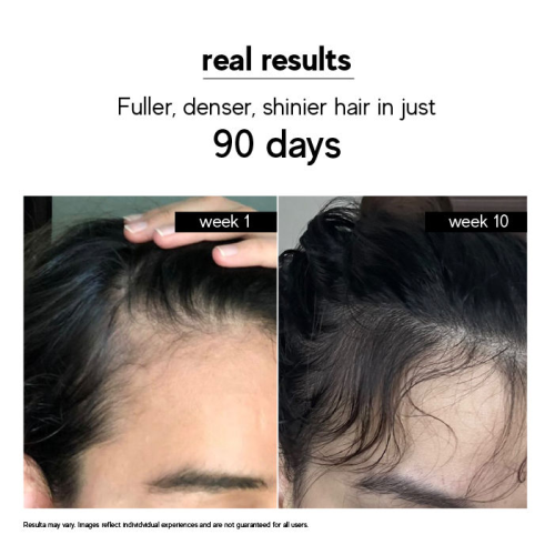 Inde Wild: Moonlight Scalp Serum with Moringa, Bhringraj & Amla for Regrowth, Healthy Scalp & Hair Density (50ml)