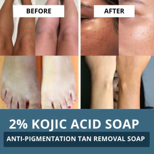 Bake Cosmetics: 2% Kojic Acid Scrub Soap for Pigmentation, Dark Spots & Tan Removal with Alpha Arbutin & MelasaRx- (Pack of 3 - 100gm x 3)