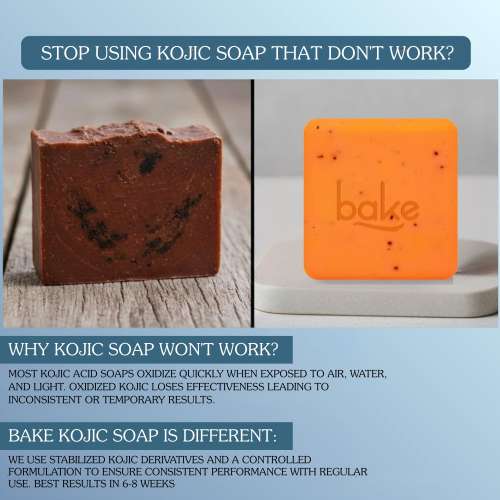 Bake Cosmetics: 2% Kojic Acid Soap with Alpha Arbutin, Lactic Acid & Niacinamide for Pigmentation, Dark Spots, Tan Removal, Brightens Underarms (Pack of 2 - 100gm x 2)