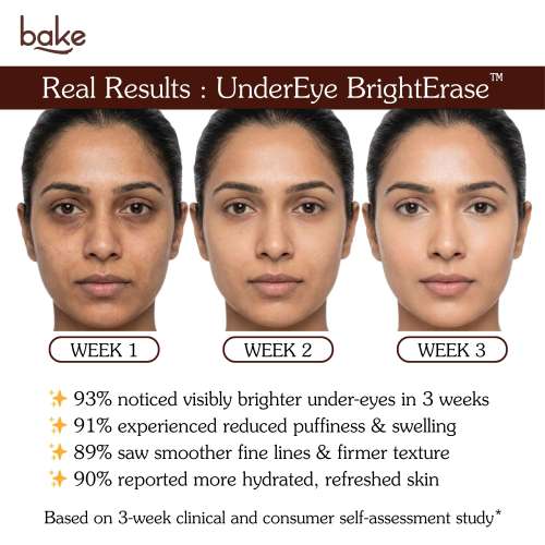 Bake Cosmetics: Under Eye Cream with 2% Caffeine for Dark Circles, Puffiness, Fine Lines & Crows Feet for Men & Women  30gm