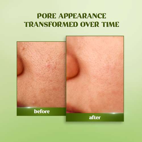 Renee Cosmetics: Matcha Toner 60ml