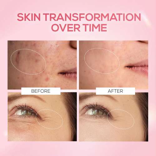 Renee Cosmetics: Pink Therapy PDRN Serum 30ml