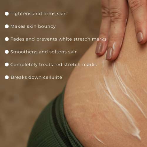 Skinvest: Bomb Bum Cream for Stretch Marks & Cellulite | Pregnancy-Safe Body Tightening Cream with Caffeine & Peptides | Built-In 5-Ball Massager for Firming, Smoothing & Elasticity | 100ml