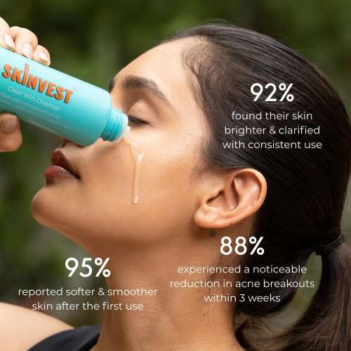 Skinvest: Clear Win Face Cleanser for Acne & Pimple-Prone Skin | 1% Salicylic Acid, Aloe Vera & pH 5.5 | Deep Cleansing, Hydrating & Brightening | Non-Stripping | 100ml