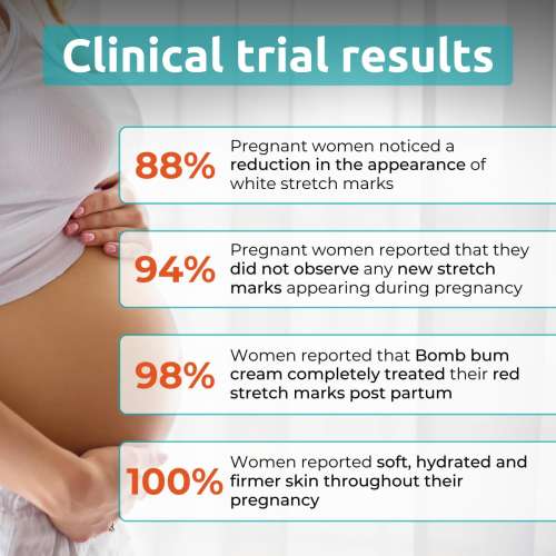 Skinvest: Bomb Bum Cream for Stretch Marks & Cellulite | Pregnancy-Safe Body Tightening Cream with Caffeine & Peptides | Built-In 5-Ball Massager for Firming, Smoothing & Elasticity | 100ml