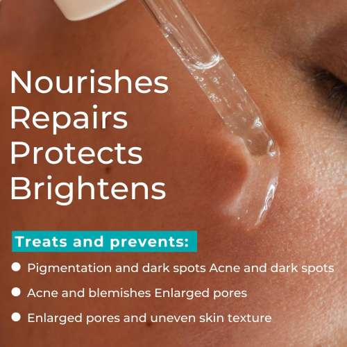 Skinvest: CEO Multi-Active Serum for Acne, Pigmentation & Pores | 25 Clinically Proven Actives with 5% Niacinamide, Peptides & Alpha Arbutin | Lightweight, Non-Sticky & Barrier-Safe | 30ml