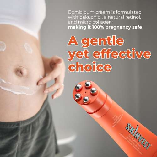 Skinvest: Bomb Bum Cream for Stretch Marks & Cellulite | Pregnancy-Safe Body Tightening Cream with Caffeine & Peptides | Built-In 5-Ball Massager for Firming, Smoothing & Elasticity | 100ml