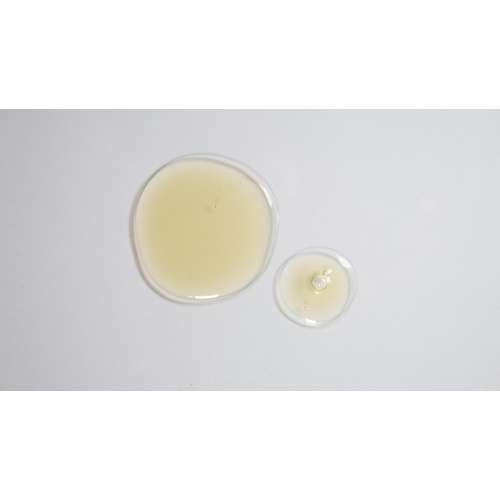 Suganda: Not So Oily Now - Oily Skin