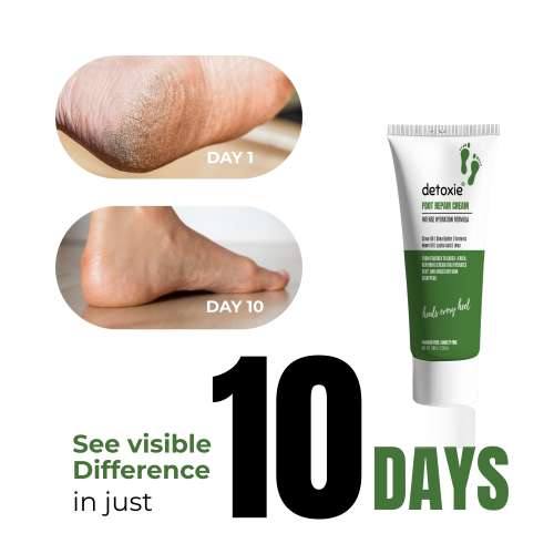 Detoxie: Foot Repair & Softening Cream 100gm