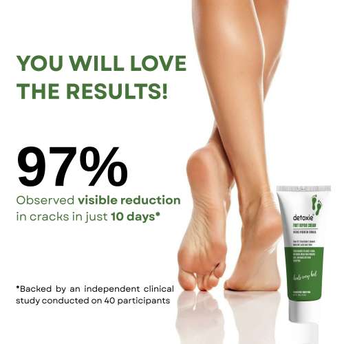 Detoxie: Foot Repair & Softening Cream 100gm
