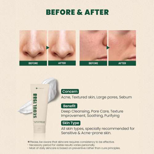 K-Secret: SEOUL 1988 Pine Cica 1% + Probiotics Cleansing Foam 150ml