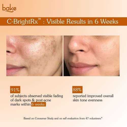 Bake Cosmetics: C-BrightFX Vitamin C Serum  5% Ethyl Ascorbic Acid + Niacinamide for Dark Spots, Pigmentation & Glow 30gm
