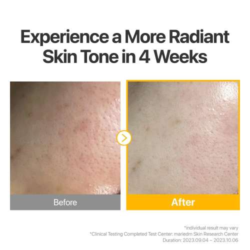 Numbuzin: No.5+ Glutathione Vitamin Concentrated Mask 27ml*5ea
