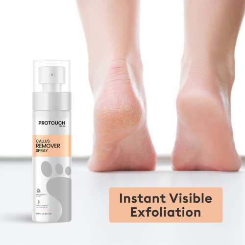 Protouch: Callus Remover Spray | Natural Exfoliation with Green Tea Extract and Aloe Vera Extract | Nourishing Coconut Oil & Olive Oil | Instantly Smooth, Soft Feet |100ml | Pack of 2