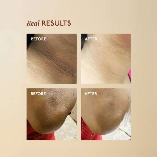 Asaya: Tone Restore Knee-Neck-Elbow Cream 50gm