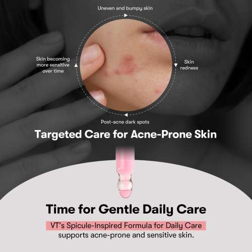 VT Cosmetics: Azelaic Acid Ampoule | Hydrating | Calm Redness | For Sensitive Skin | Healthy Skin | 30ml