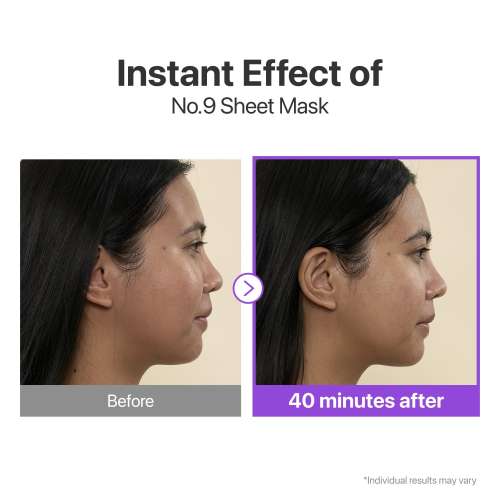Numbuzin: No.9+ Nad+ Bio Lifting-Sil Full Face Mask 28ml*4ea
