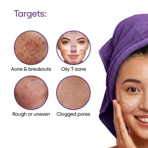 Ethiglo: Acmed Pimple Care Face Wash for Acne Prone Skin 200gm