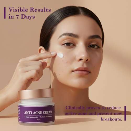 Milky Moon: Anti Acne Cream for Clears Acne & Pimple Quickly and Reduces Inflammation, 25gm | Reduces Breakouts & Dark Spots | For Women & Men, Work on all Skin Type