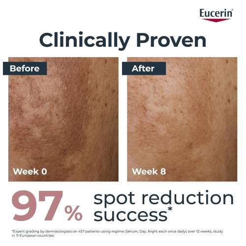 Eucerin: Anti Pigment Dual Serum 30ml
