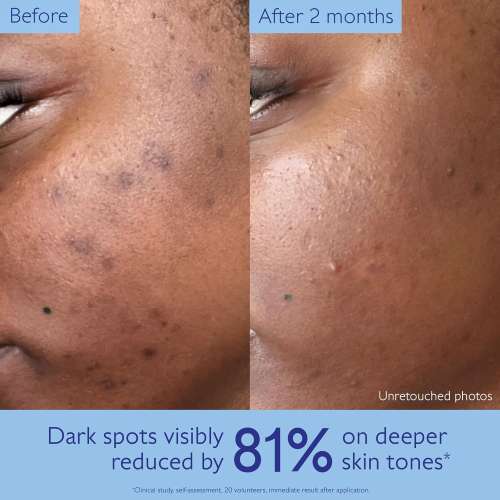 Caudalie: Vinoperfect Brightening Dark Spot Serum 30ml